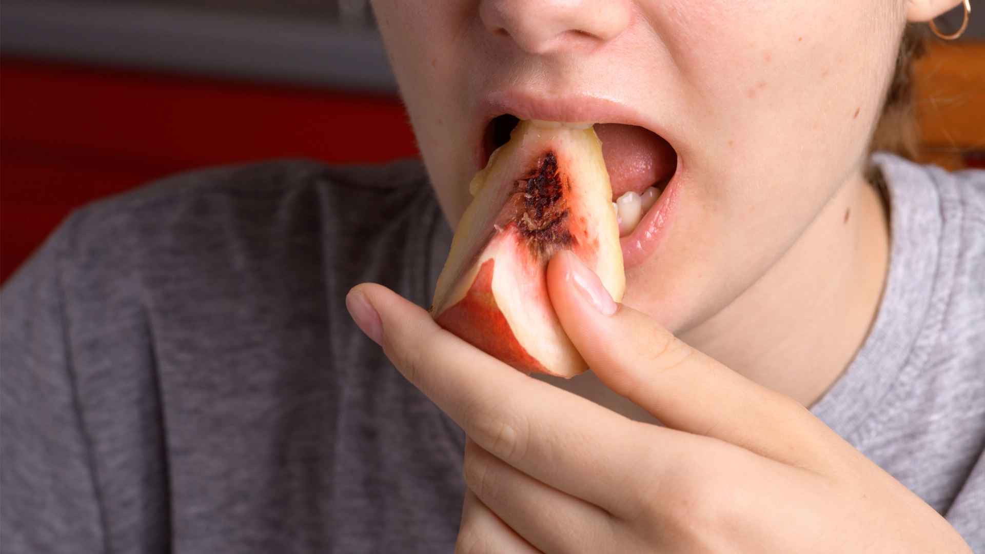 You are currently viewing The Role of Diet in Preventing Gum Disease